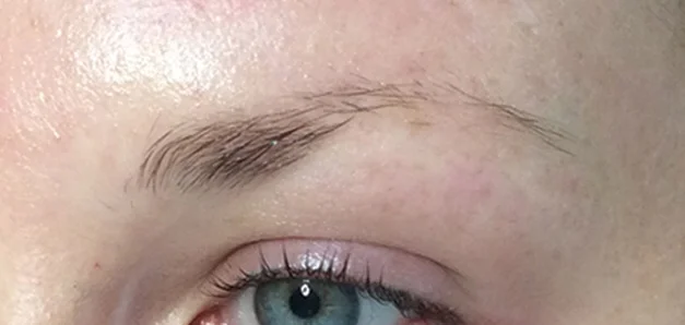 Eyebrow before microblading, from the Seoul Medi Spa gallery